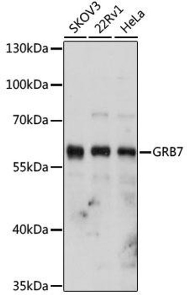 Cell Biology Antibodies 9 Anti-GRB7 Antibody CAB5690