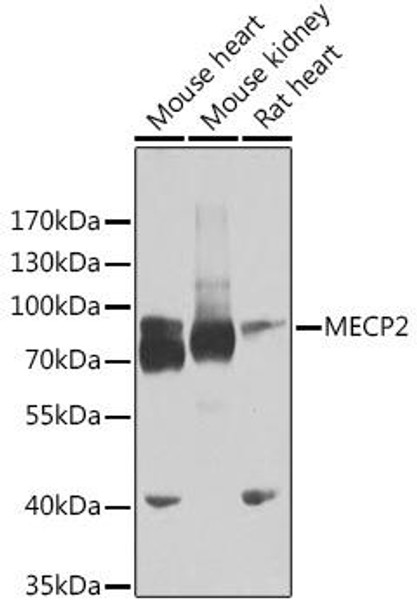 Epigenetics and Nuclear Signaling Antibodies 2 Anti-MECP2 Antibody CAB5694