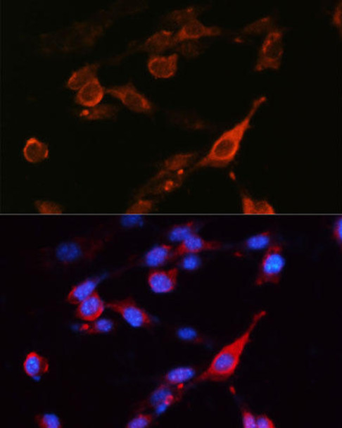 Signal Transduction Antibodies 3 Anti-CD98 Antibody CAB5702