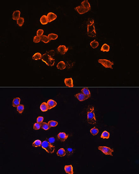 Immunology Antibodies 2 Anti-CD14 Antibody CAB5737