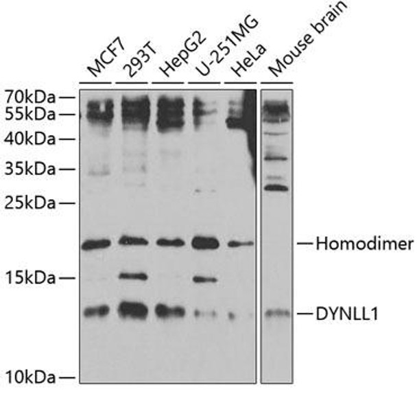 Cell Death Antibodies 2 Anti-DYNLL1 Antibody CAB5742