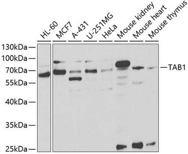 Cell Biology Antibodies 9 Anti-TAB1 Antibody CAB5749