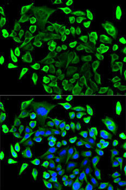 Cell Biology Antibodies 9 Anti-TAB1 Antibody CAB5749