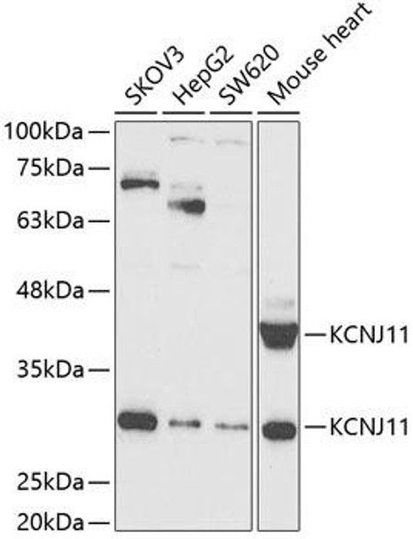 Signal Transduction Antibodies 3 Anti-KCNJ11 Antibody CAB5765
