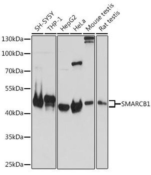 KO Validated Antibodies 1 Anti-SMARCB1 Antibody CAB5767KO Validated