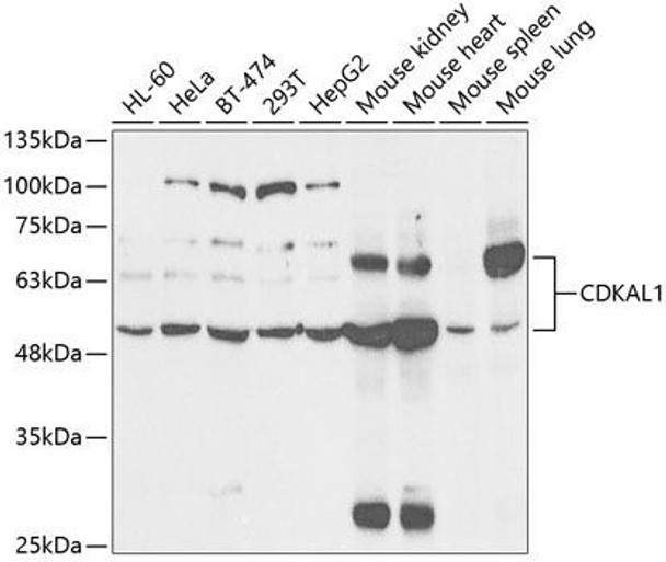 Epigenetics and Nuclear Signaling Antibodies 2 Anti-CDKAL1 Antibody CAB5771