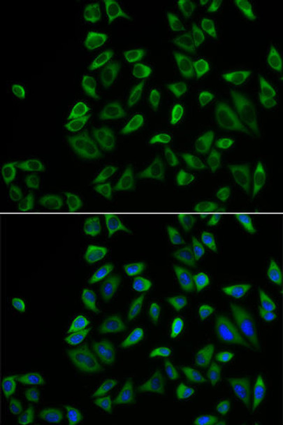 Cell Biology Antibodies 9 Anti-PEX5 Antibody CAB5780