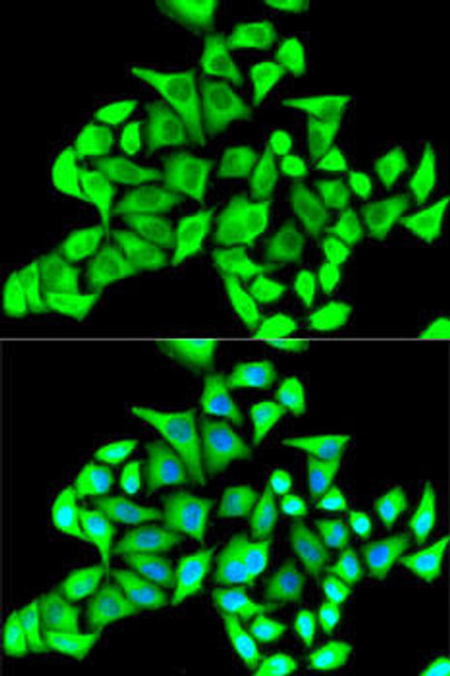 Cell Biology Antibodies 9 Anti-CD22 Antibody CAB5790