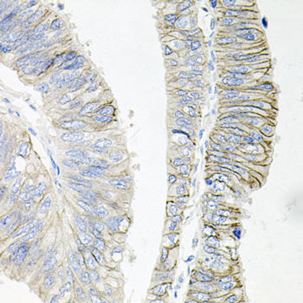 Cell Biology Antibodies 9 Anti-ATP1B1 Antibody CAB5793