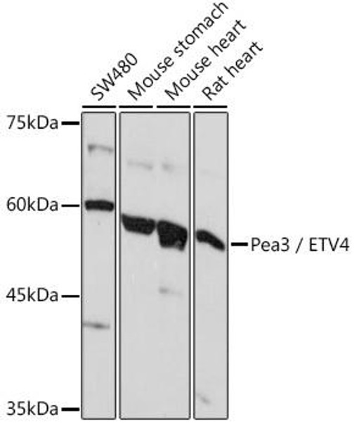 Epigenetics and Nuclear Signaling Antibodies 2 Anti-Pea3 / ETV4 Antibody CAB5797