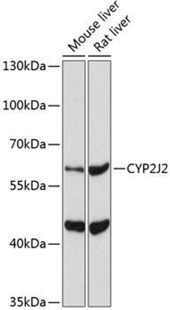Metabolism Antibodies 2 Anti-CYP2J2 Antibody CAB5805