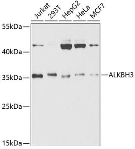 Epigenetics and Nuclear Signaling Antibodies 2 Anti-ALKBH3 Antibody CAB5808