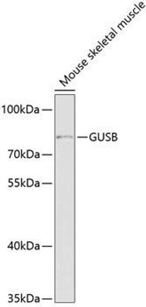 Cell Biology Antibodies 9 Anti-GUSB Antibody CAB5813