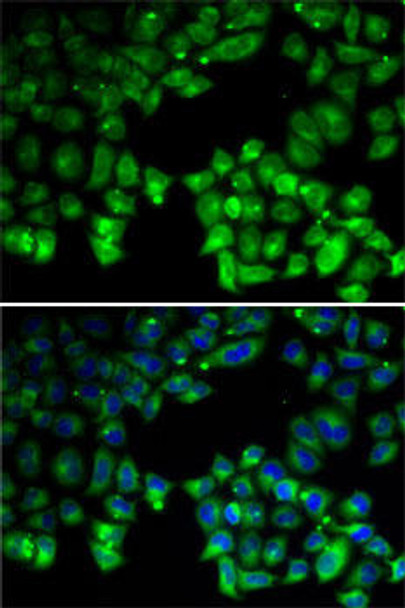 Epigenetics and Nuclear Signaling Antibodies 2 Anti-NEIL-1 Antibody CAB5828