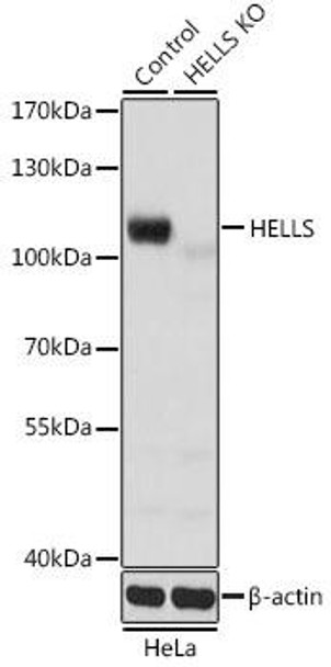 KO Validated Antibodies 1 Anti-HELLS Antibody CAB5831KO Validated