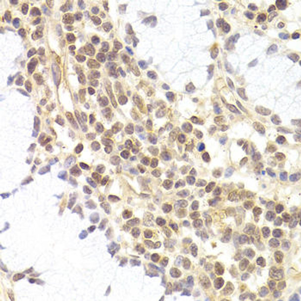 Cell Biology Antibodies 9 Anti-PHC1 Antibody CAB5843