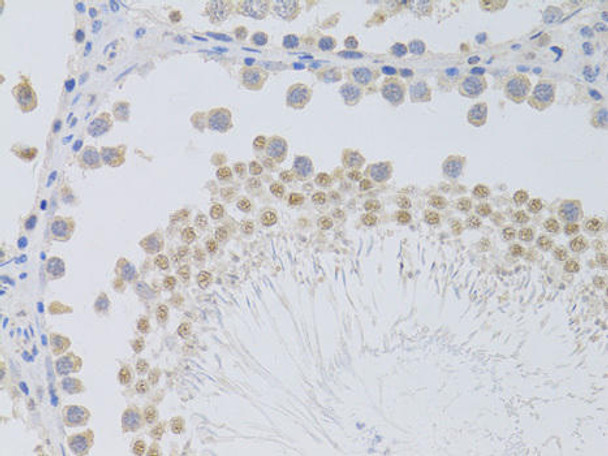Cell Biology Antibodies 9 Anti-PHC1 Antibody CAB5843