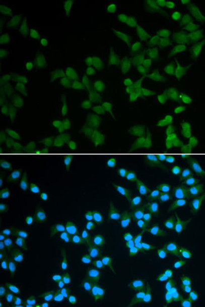 Cell Cycle Antibodies 1 Anti-SPIN1 Antibody CAB5853