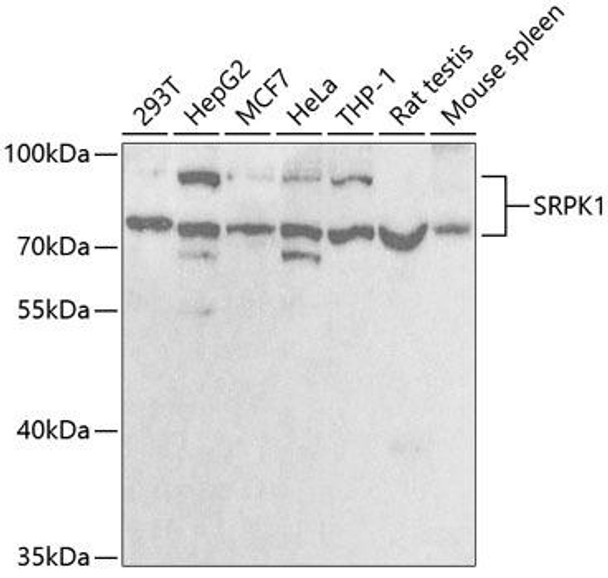 Epigenetics and Nuclear Signaling Antibodies 2 Anti-SRPK1 Antibody CAB5854