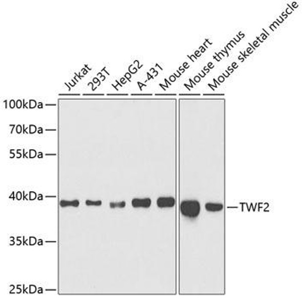 Cell Biology Antibodies 9 Anti-TWF2 Antibody CAB5860