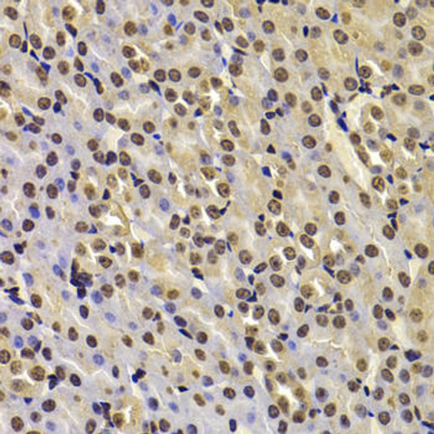 Cell Biology Antibodies 9 Anti-FBXW7 Antibody CAB5872