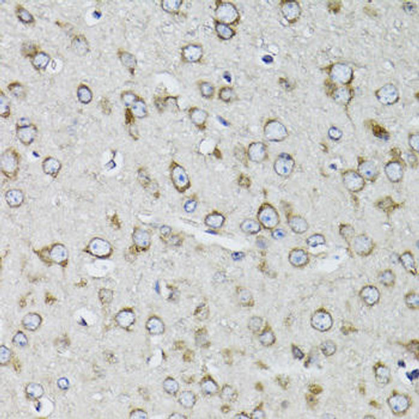 Cell Biology Antibodies 9 Anti-RPS10 Antibody CAB5880