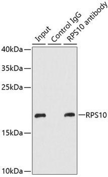 Cell Biology Antibodies 9 Anti-RPS10 Antibody CAB5880