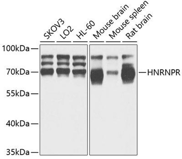 Epigenetics and Nuclear Signaling Antibodies 2 Anti-HNRNPR Antibody CAB5883