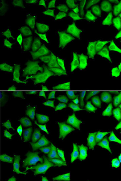 Cell Biology Antibodies 9 Anti-RPS12 Antibody CAB5890