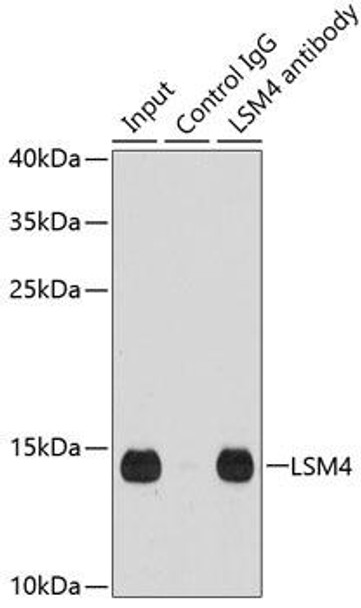 Epigenetics and Nuclear Signaling Antibodies 2 Anti-LSM4 Antibody CAB5891