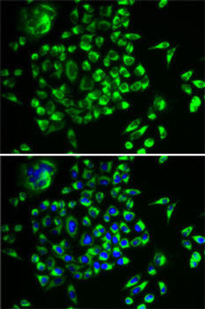 Cell Biology Antibodies 9 Anti-MRPL28 Antibody CAB5897