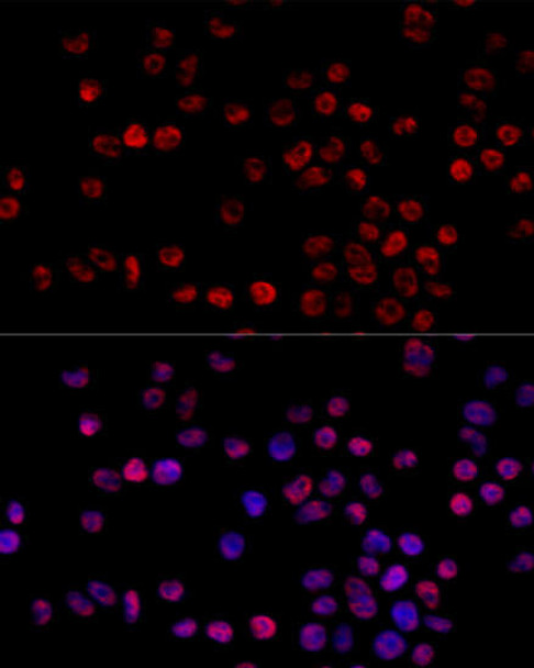 Epigenetics and Nuclear Signaling Antibodies 2 Anti-HNRNPH1 Antibody CAB5924