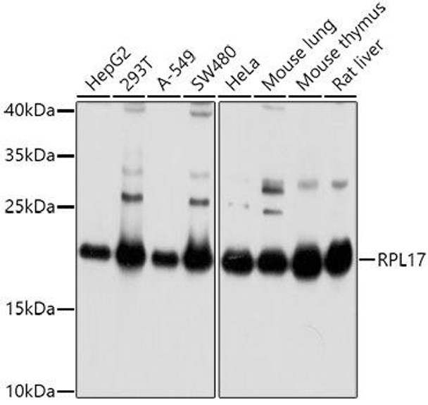 Cell Biology Antibodies 9 Anti-RPL17 Antibody CAB5934