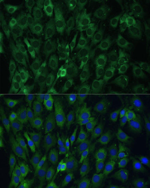 Immunology Antibodies 2 Anti-EIF3D Antibody CAB5947