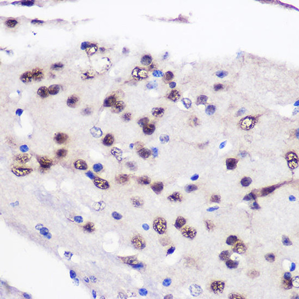 Epigenetics and Nuclear Signaling Antibodies 2 Anti-CELF1 Antibody CAB5958