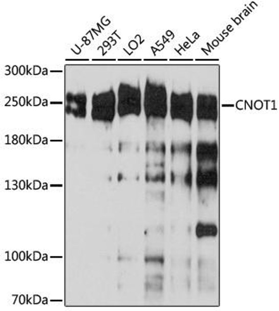 Epigenetics and Nuclear Signaling Antibodies 2 Anti-CNOT1 Antibody CAB5969