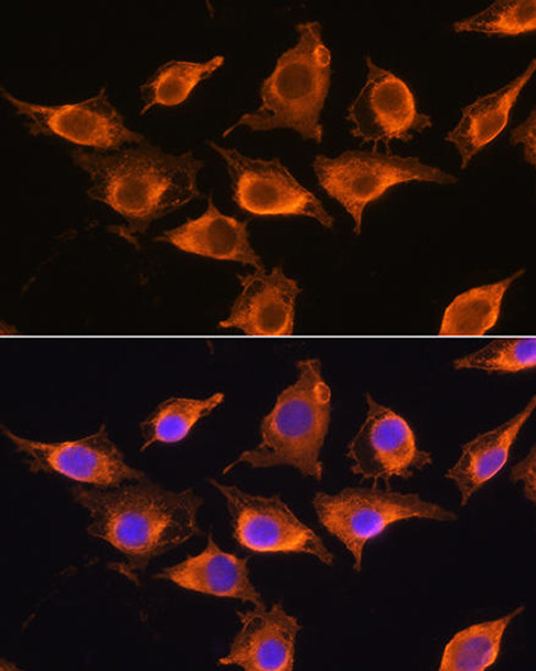 Epigenetics and Nuclear Signaling Antibodies 2 Anti-ZCCHC11 Antibody CAB5972