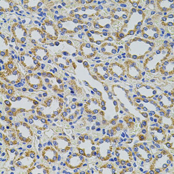 Cell Biology Antibodies 9 Anti-TRMT2A Antibody CAB5975