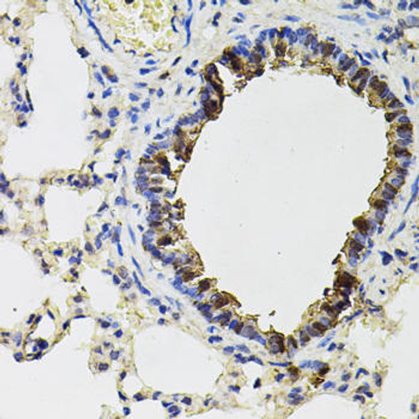 Metabolism Antibodies 2 Anti-IREB1 Antibody CAB6008