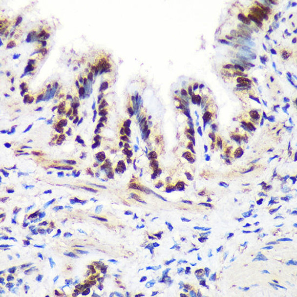 Immunology Antibodies 2 Anti-ALYREF Antibody CAB6010