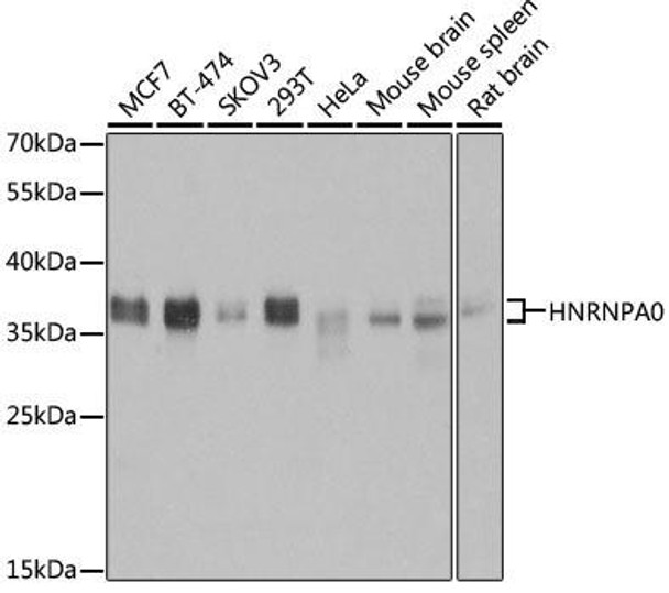 Cell Biology Antibodies 9 Anti-HNRNPA0 Antibody CAB6029