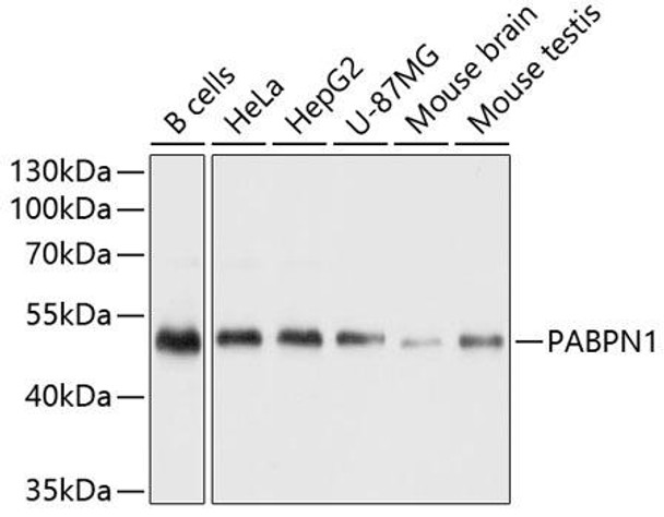 Epigenetics and Nuclear Signaling Antibodies 2 Anti-PABPN1 Antibody CAB6041