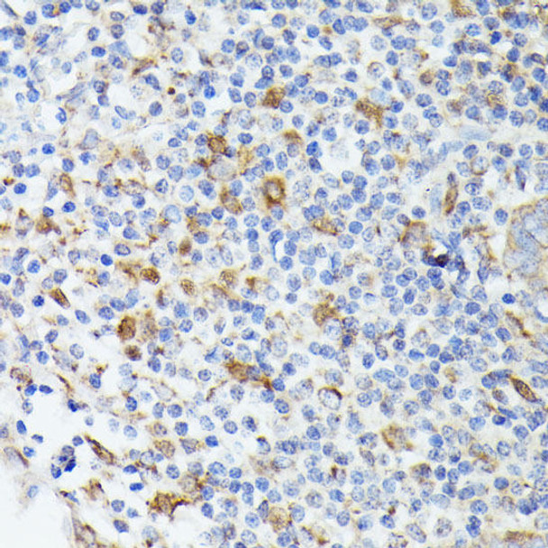 Cell Death Antibodies 2 Anti-TIAL1 Antibody CAB6075