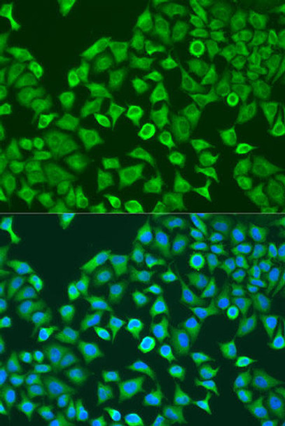 Developmental Biology Anti-PUM1 Antibody CAB6108