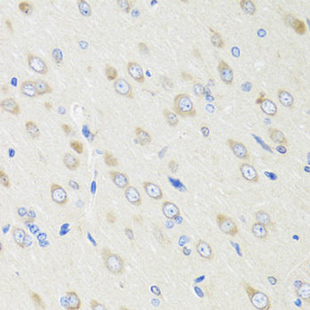 Signal Transduction Antibodies 3 Anti-CRABP2 Antibody CAB6119