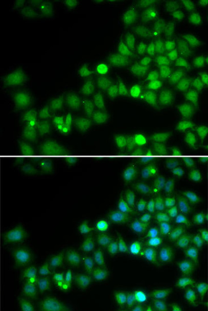 Epigenetics and Nuclear Signaling Antibodies 2 Anti-POLK Antibody CAB6122