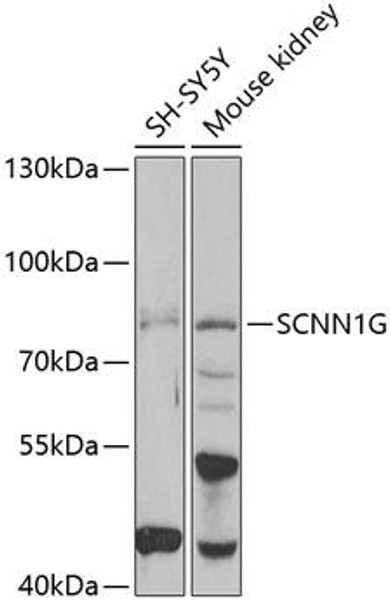 Signal Transduction Antibodies 3 Anti-SCNN1G Antibody CAB6126