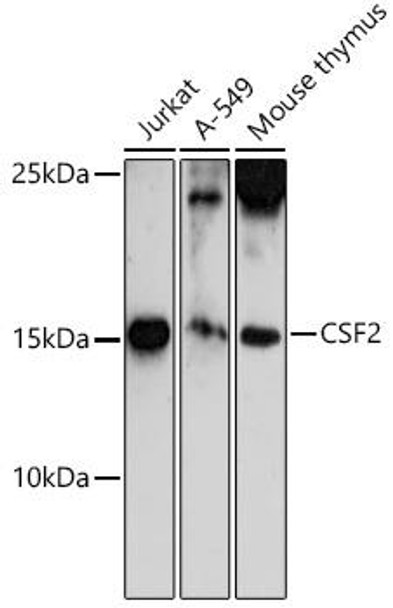 Cell Biology Antibodies 9 Anti-CSF2 Antibody CAB6127