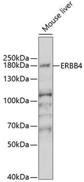 Cell Death Antibodies 2 Anti-ERBB4 Antibody CAB6133