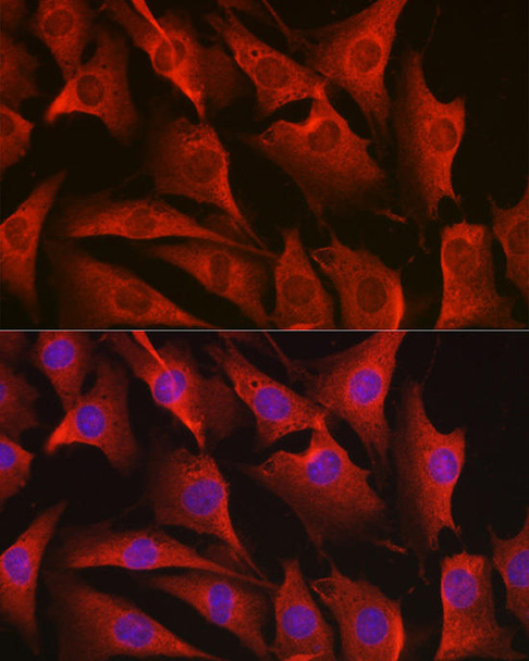 Cell Death Antibodies 2 Anti-ERBB4 Antibody CAB6133